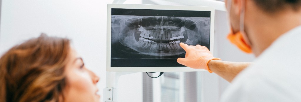 Digital Dental X-Rays, Surrey Dentist